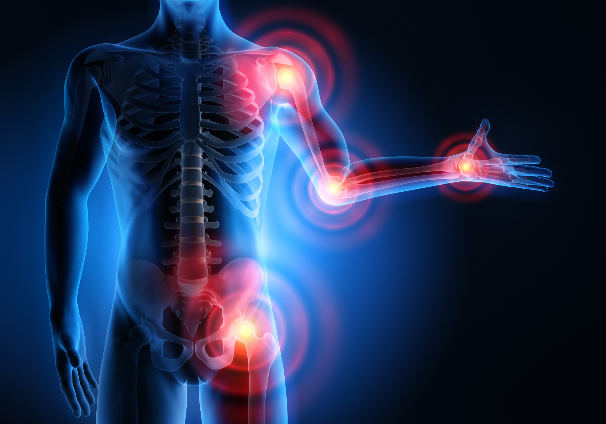 Klouby a jejich anatomie